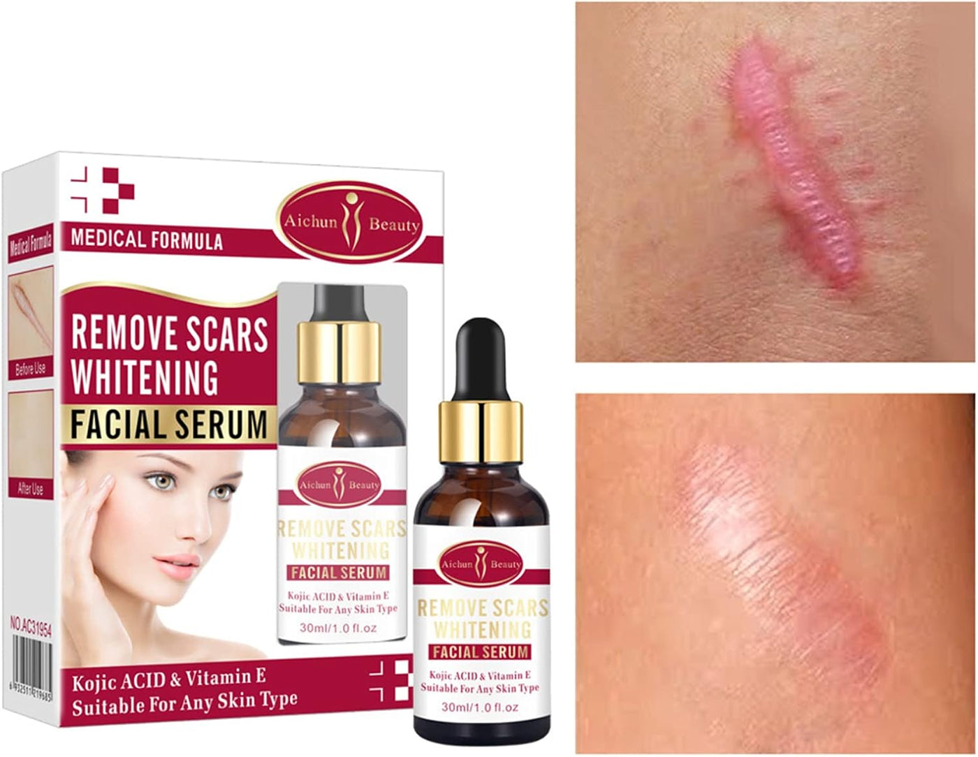 Aichun Beauty Scar Removal Facial Serum Pimple